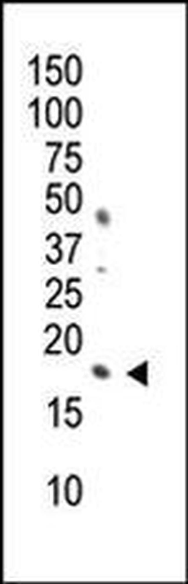Phospho-Histone H3 (Ser10) Antibody in Western Blot (WB)