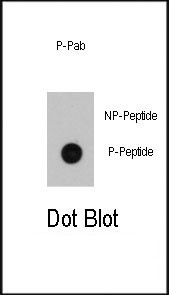 Phospho-ILK (Ser246) Antibody in Dot Blot (DB)