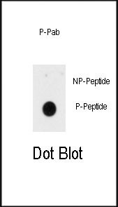 Phospho-INSR (Tyr1185) Antibody in Dot Blot (DB)