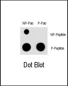 Phospho-MEF2C (Ser396) Antibody in Dot Blot (DB)