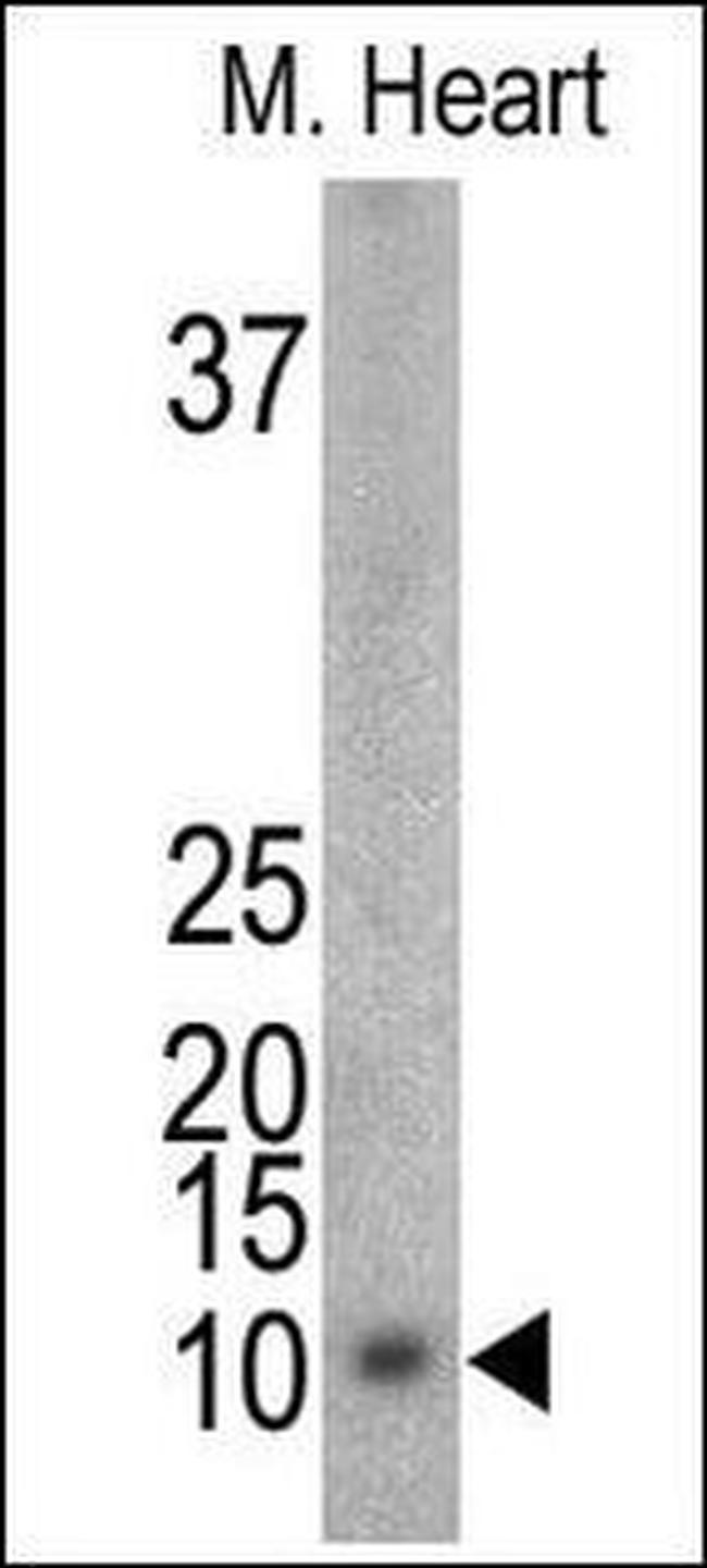 Phospho-FXYD1 (Ser88) Antibody in Western Blot (WB)