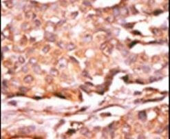 Phospho-RAD9 (Ser272) Antibody in Immunohistochemistry (IHC)