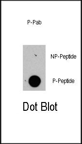 Phospho-Raptor (Ser863) Antibody in Dot Blot (DB)