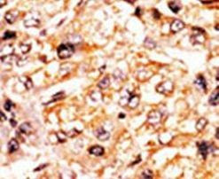 Phospho-RBL1 (Ser975) Antibody in Immunohistochemistry (IHC)