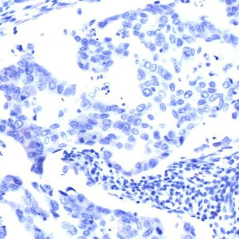 Phospho-S6 (Ser235, Ser236) Antibody in Immunohistochemistry (IHC)