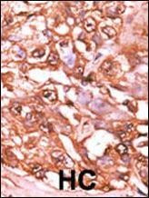 Phospho-STAT5 alpha (Ser726) Antibody in Immunohistochemistry (IHC)