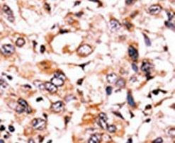 Phospho-WEE1 (Ser123) Antibody in Immunohistochemistry (IHC)