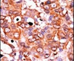 Phospho-Wee1 (Ser53) Antibody in Immunohistochemistry (IHC)