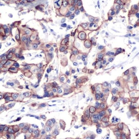 Phospho-ErbB2 (HER-2) (Tyr1248) Antibody in Immunohistochemistry (IHC)