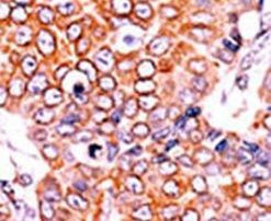 Phospho-p16INK4a (Ser152) Antibody in Immunohistochemistry (IHC)