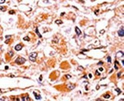 Phospho-p16INK4a (Ser7) Antibody in Immunohistochemistry (IHC)