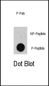 Phospho-p53 (Thr55) Antibody in Dot Blot (DB)