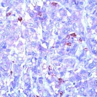 Phosphotyrosine Antibody in Immunohistochemistry (IHC)