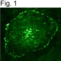 Phosphotyrosine Antibody in Immunocytochemistry (ICC/IF)