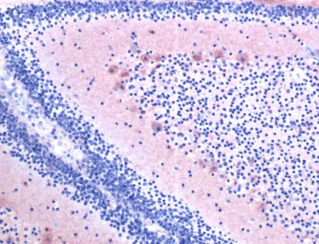 Pleiotrophin Antibody in Immunohistochemistry (IHC)