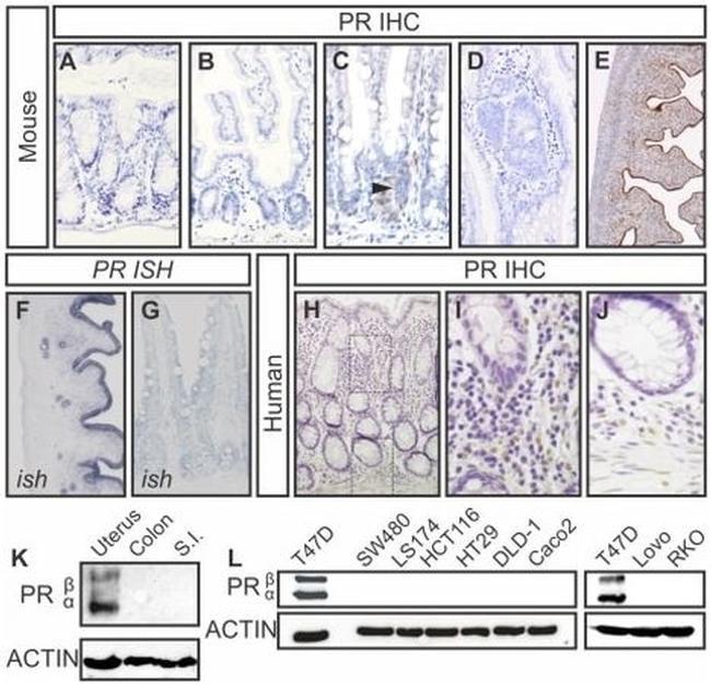 Progesterone Receptor Monoclonal Antibody [C262] main image 0