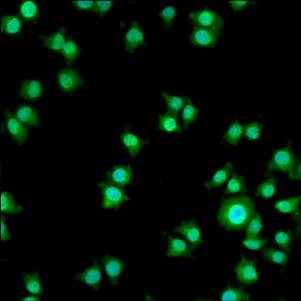 Progestin Receptor beta Antibody in Immunocytochemistry (ICC/IF)