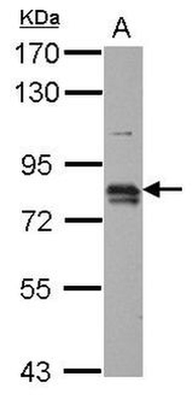 Prolactin Receptor Antibody in Western Blot (WB)