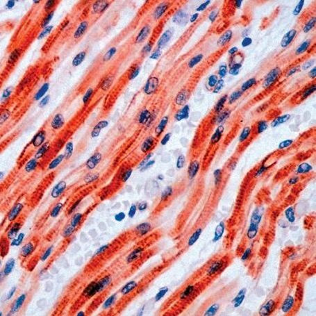 PAR4 Antibody in Immunohistochemistry (IHC)