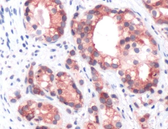 PSCA Antibody in Immunohistochemistry (IHC)