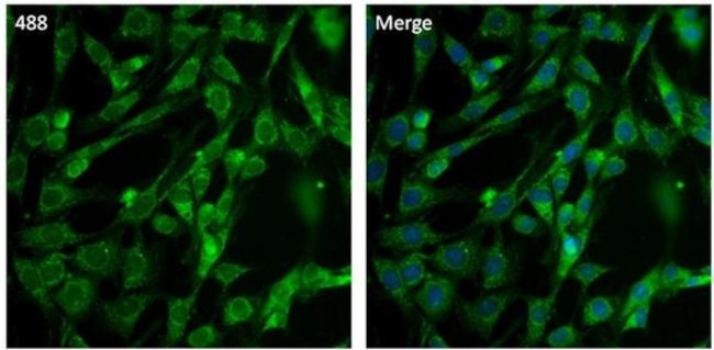 PSMD3 Antibody in Immunocytochemistry (ICC/IF)