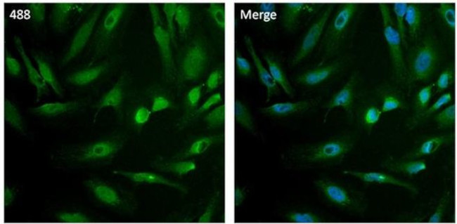 PSMB6 Antibody in Immunocytochemistry (ICC/IF)