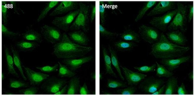 PSMB8 Antibody in Immunocytochemistry (ICC/IF)