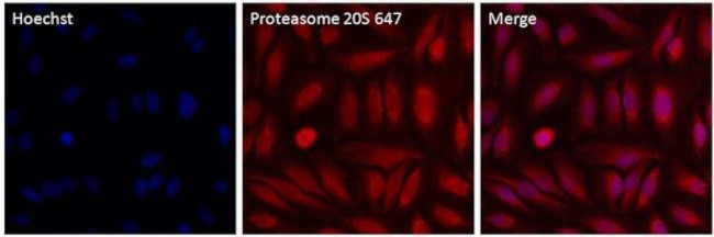 PSMB6 Antibody in Immunocytochemistry (ICC/IF)