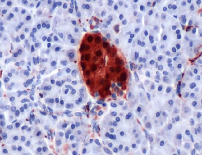 PGP9.5 Antibody in Immunohistochemistry (IHC)