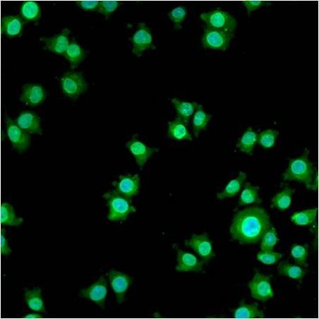Progestin Receptor beta Antibody in Immunocytochemistry (ICC/IF)