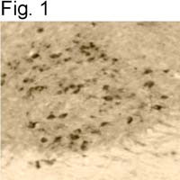Pseudorabies Virus Antibody in Immunohistochemistry (IHC)