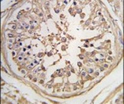 PUM1 Antibody in Immunohistochemistry (IHC)