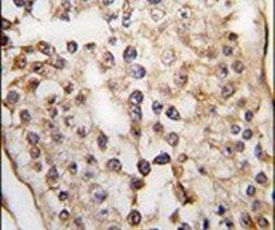PUM2 Antibody in Immunohistochemistry (IHC)