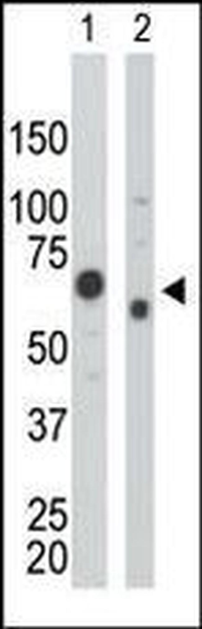 PKM2 Antibody in Western Blot (WB)