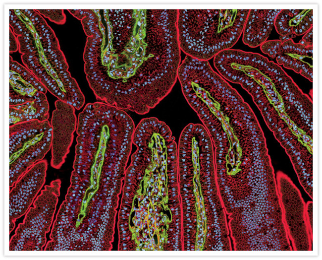 Human IgG (H+L) Secondary Antibody in Multiplex Immunohistochemistry (mIHC)