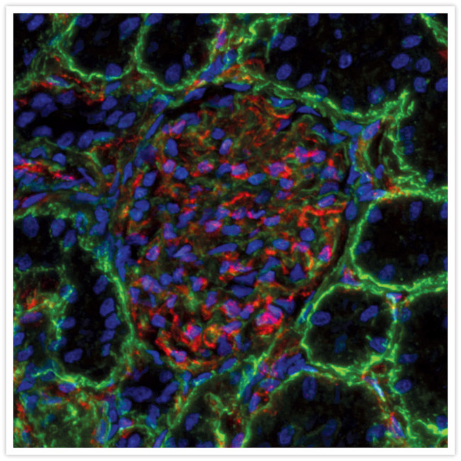 Rabbit IgG (H+L) Secondary Antibody in Immunohistochemistry (IHC)
