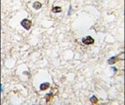 QKI Antibody in Immunohistochemistry (IHC)