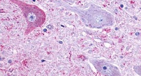 QRFPR Antibody in Immunohistochemistry (Paraffin) (IHC (P))