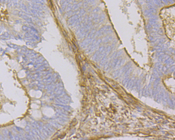 Beta Actin Antibody in Immunohistochemistry (Paraffin) (IHC (P))
