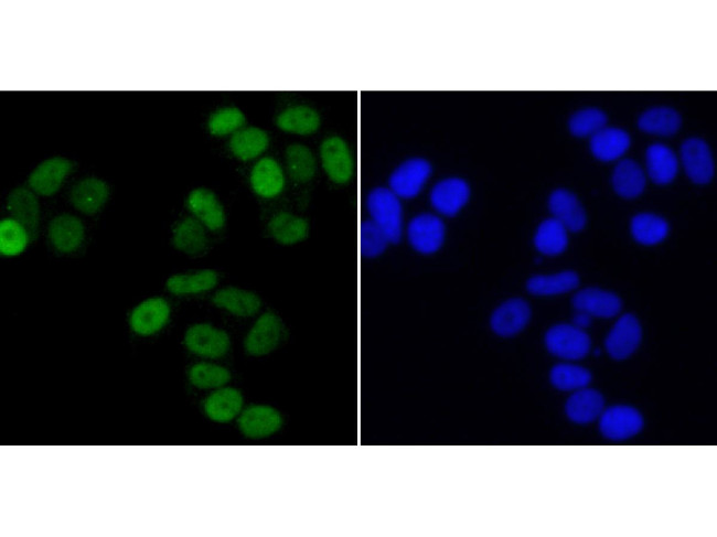 TRIM28 Antibody in Immunocytochemistry (ICC/IF)