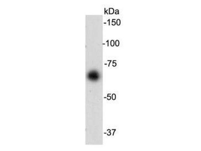 Serum Albumin Antibody in Western Blot (WB)