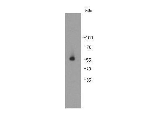 Autoimmune regulator (AIRE) Antibody in Western Blot (WB)