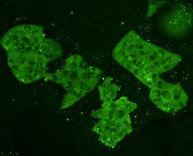 Nrf2 Antibody in Immunocytochemistry (ICC/IF)