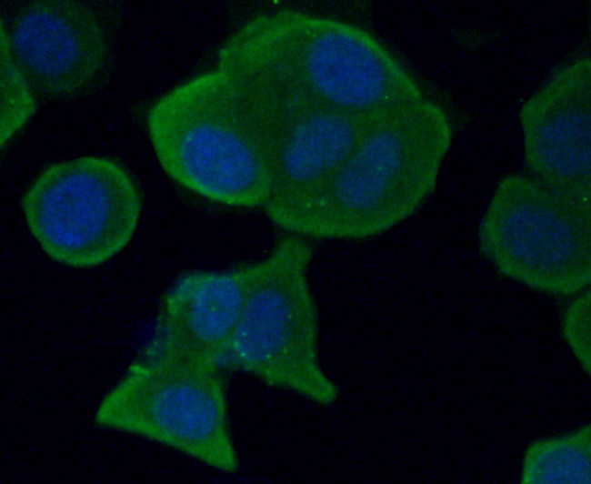AXL Antibody in Immunocytochemistry (ICC/IF)