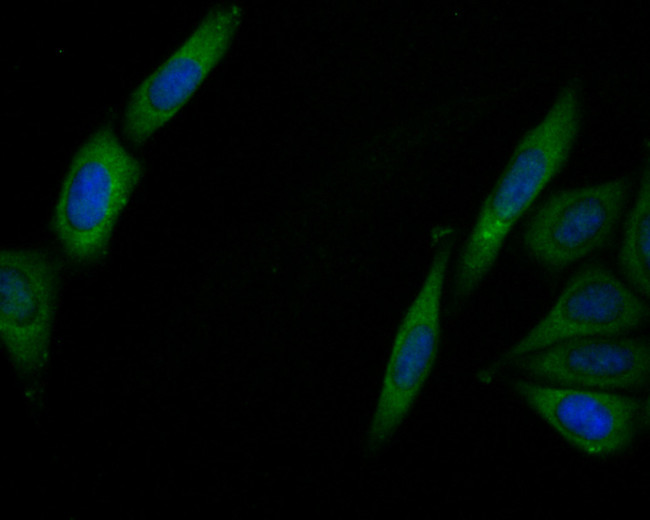IL-6 Antibody in Immunocytochemistry (ICC/IF)