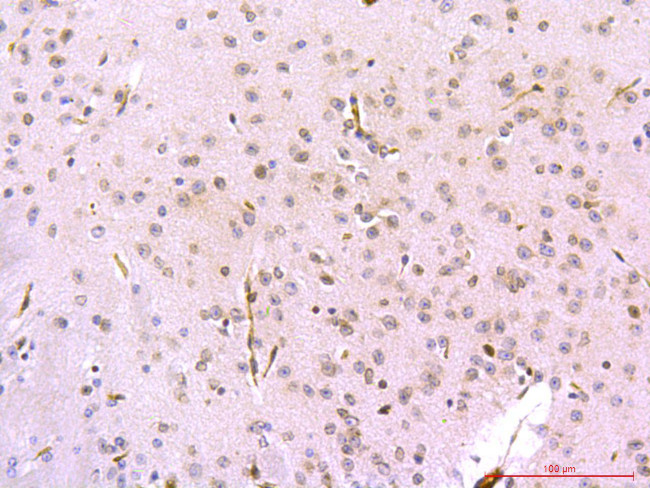 PSD95 Antibody in Immunohistochemistry (Paraffin) (IHC (P))