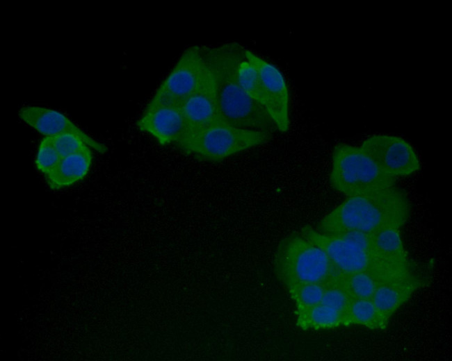 HLA-DR Antibody in Immunocytochemistry (ICC/IF)