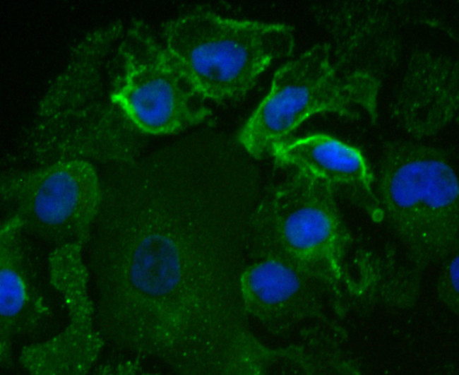 EGFR Antibody in Immunocytochemistry (ICC/IF)