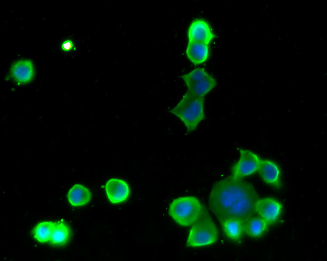 PGP9.5 Antibody in Immunocytochemistry (ICC/IF)