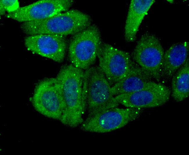 AFP Antibody in Immunocytochemistry (ICC/IF)